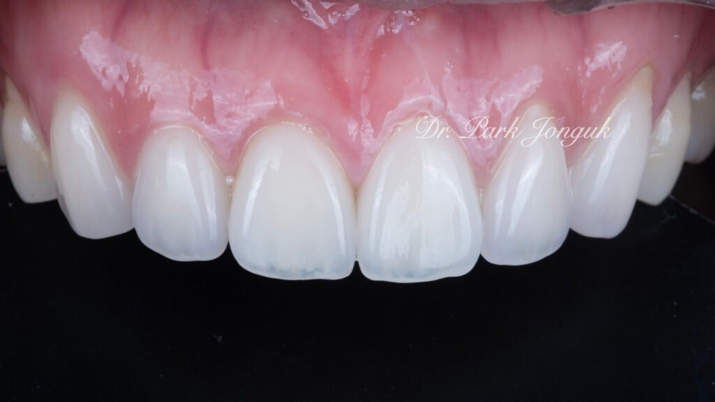 Natural veneer specialist