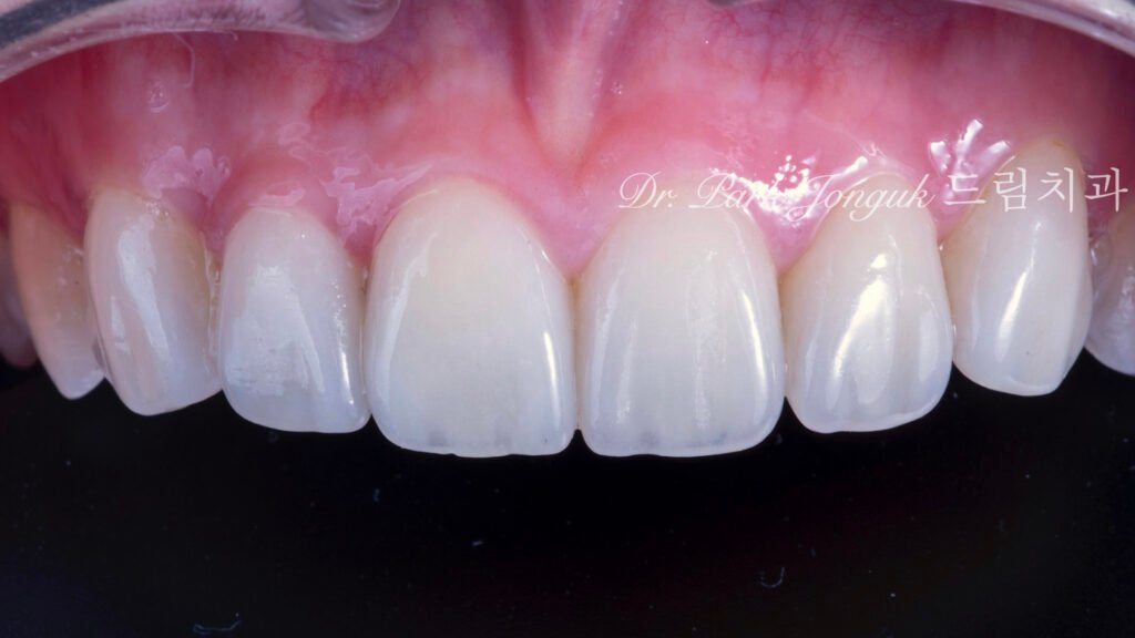 Natural veneer specialist