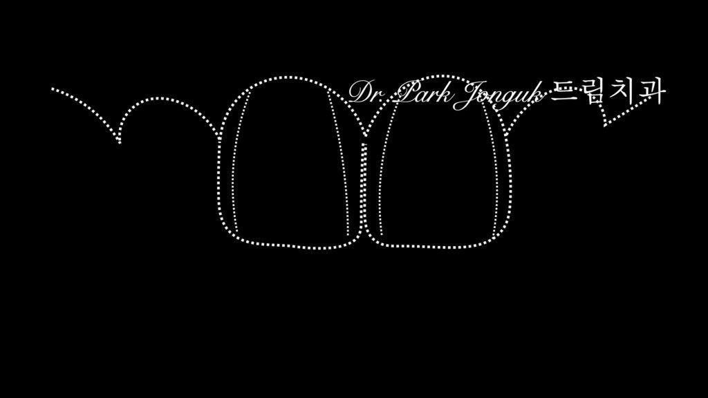 라미네이트 재시술을 위한 진단