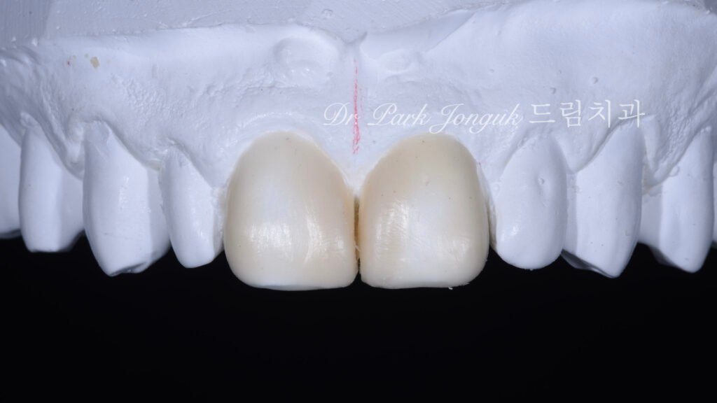 왁스업 정밀진단