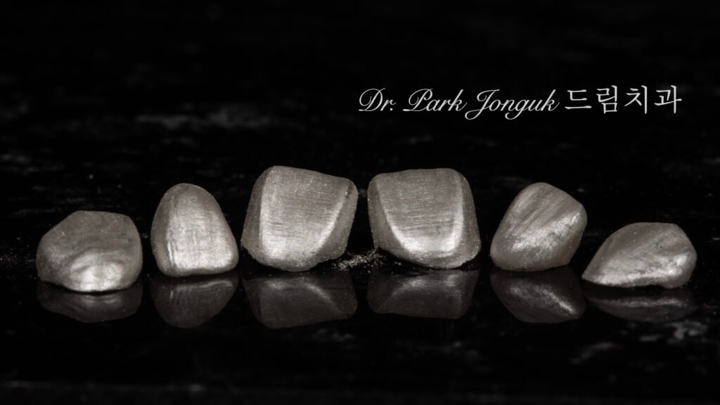 자연스러운 라미네이트를 위한 핸드메이드 빌드업 제작 과정