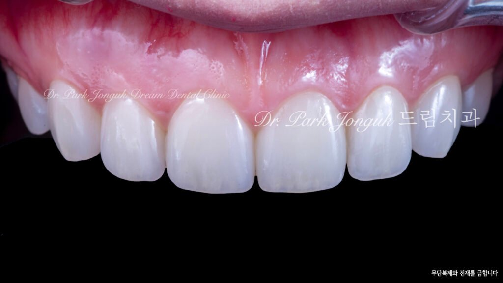 Natural veneer specialist