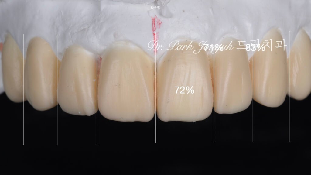 라미네이트 왁스업 정밀진단