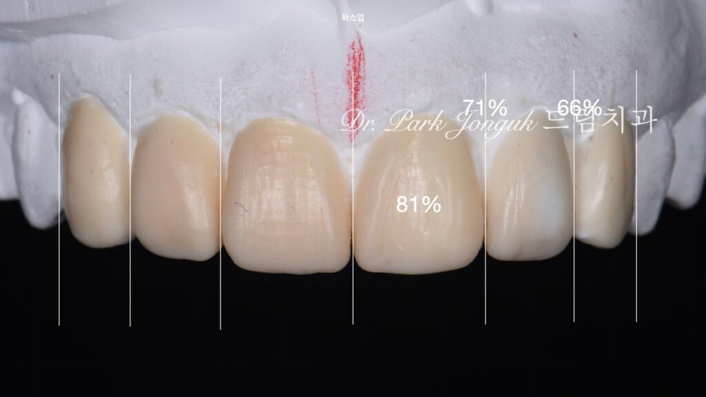 블랙트라이앵글-왁스업-진단