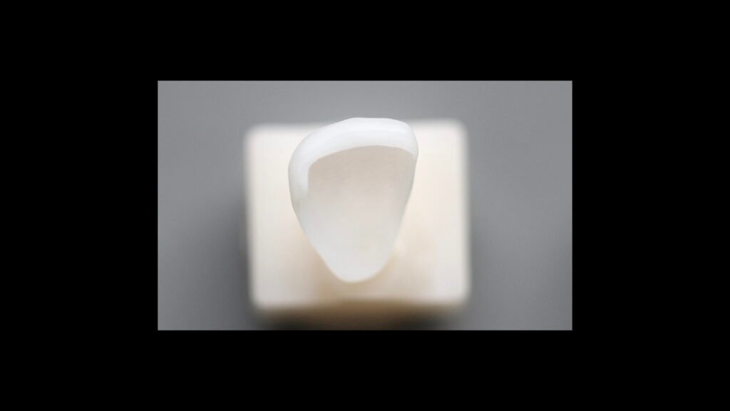 라미네이트 제작 방식에 따른 차이