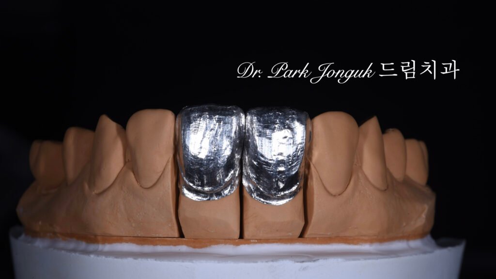 라미네이트 제작 방식에 따른 차이