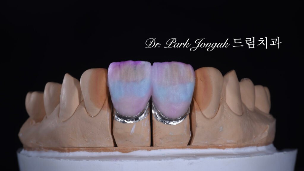 라미네이트 제작 방식에 따른 차이