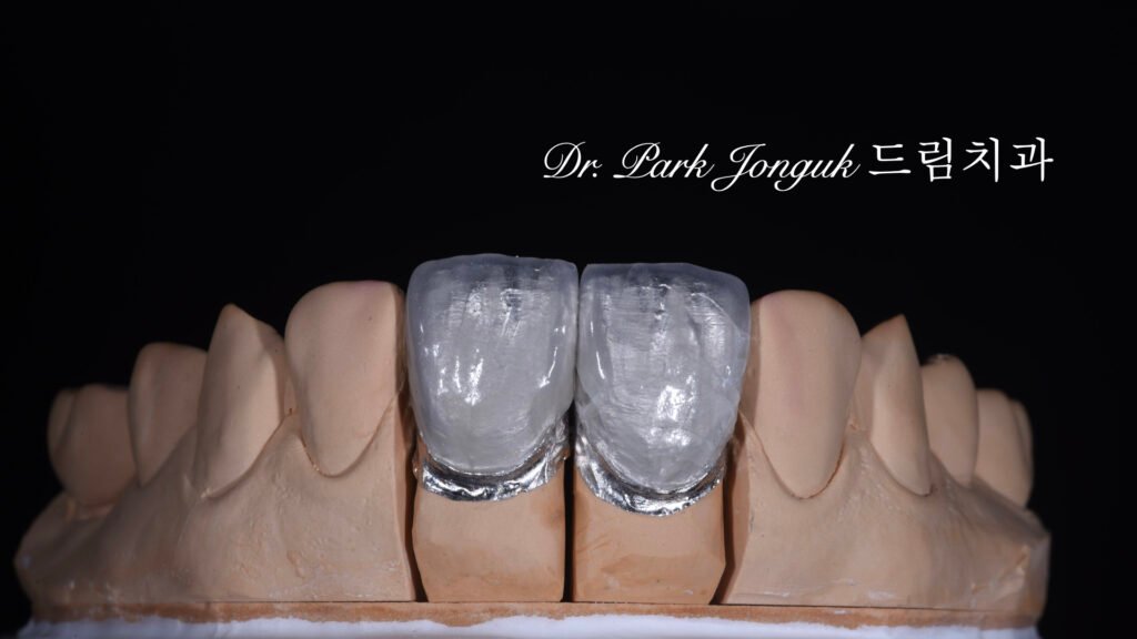 라미네이트 제작 방식에 따른 차이