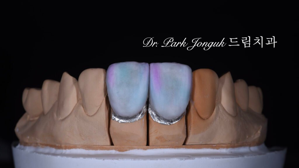 라미네이트 제작 방식에 따른 차이