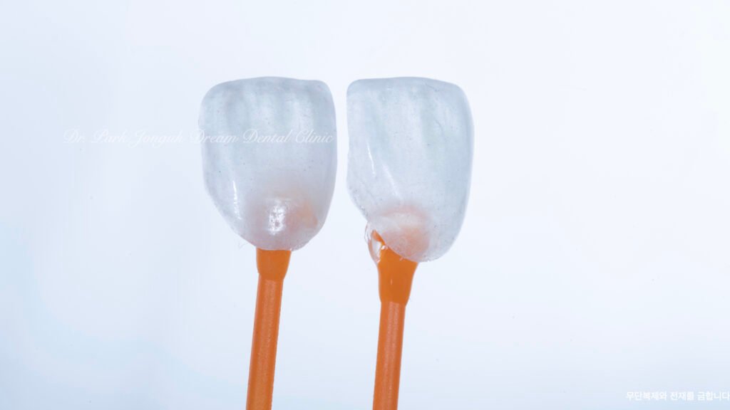 라미네이트 제작 방식에 따른 차이