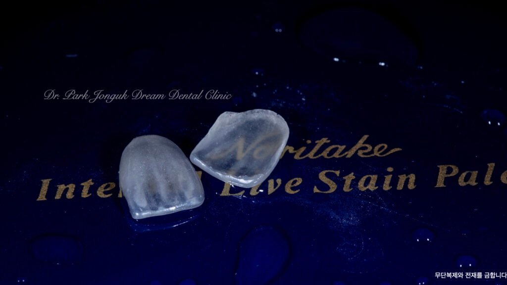 라미네이트 제작 방식에 따른 차이