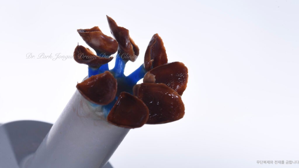 라미네이트 제작 방식에 따른 차이