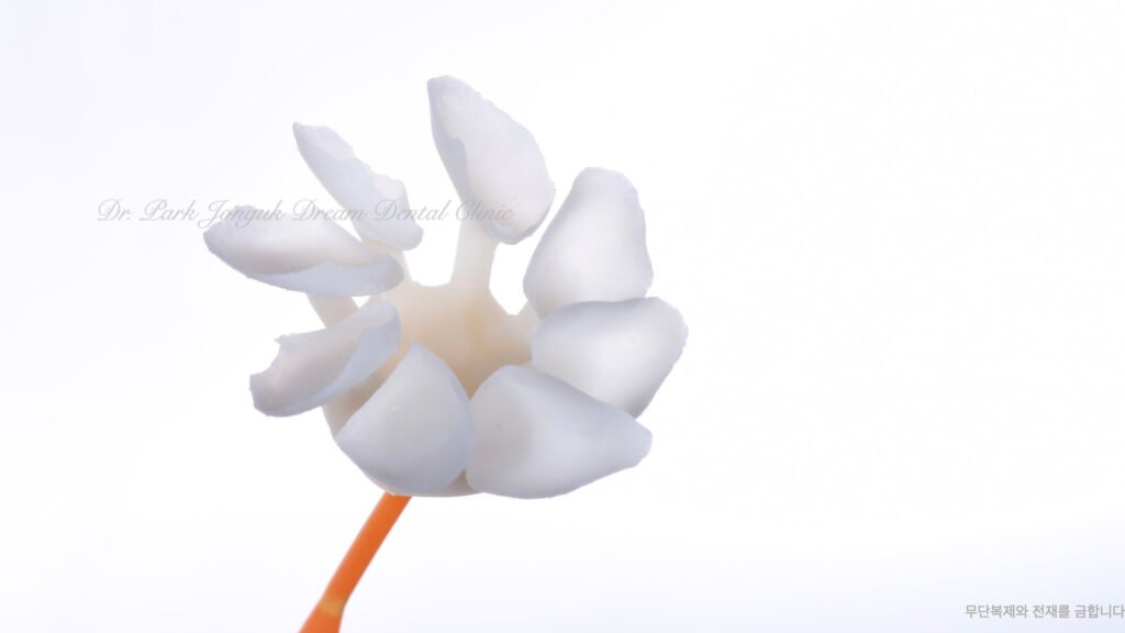 라미네이트 제작 방식에 따른 차이