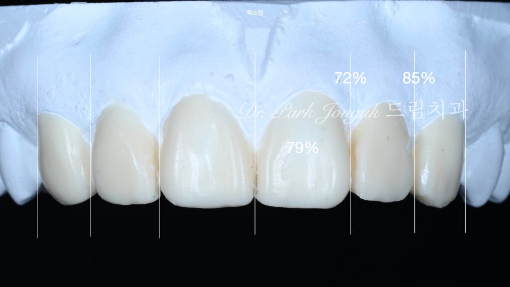 차등삭제-왁스업-진단