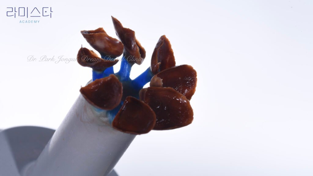 라미네이트 제작 방법, Laminate Fabrication Methods, 수작업 빌드업, Hand-Layered Build-up, CAD/CAM 밀링, CAD/CAM Milling, E-max 베이스, E-max Base, 자연스러운 라미네이트, Natural Laminate