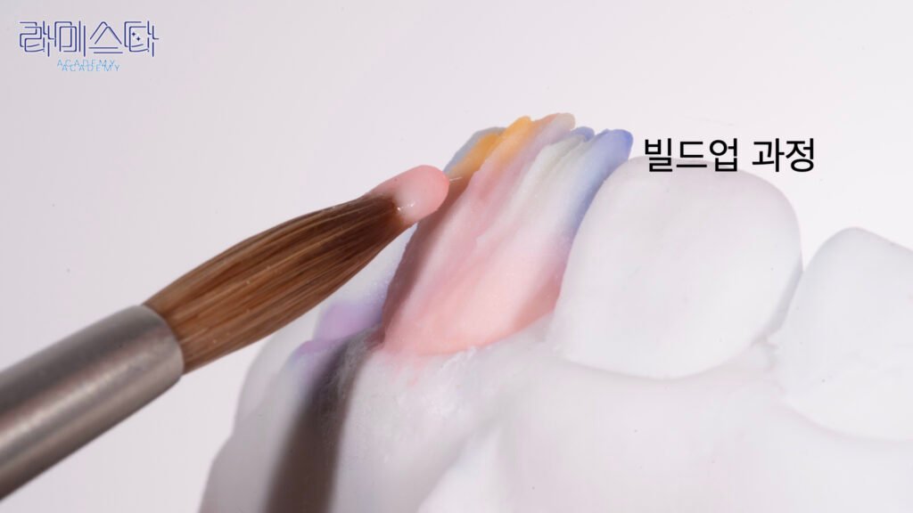 라미네이트 제작 방법, Laminate Fabrication Methods, 수작업 빌드업, Hand-Layered Build-up, CAD/CAM 밀링, CAD/CAM Milling, E-max 베이스, E-max Base, 자연스러운 라미네이트, Natural Laminate