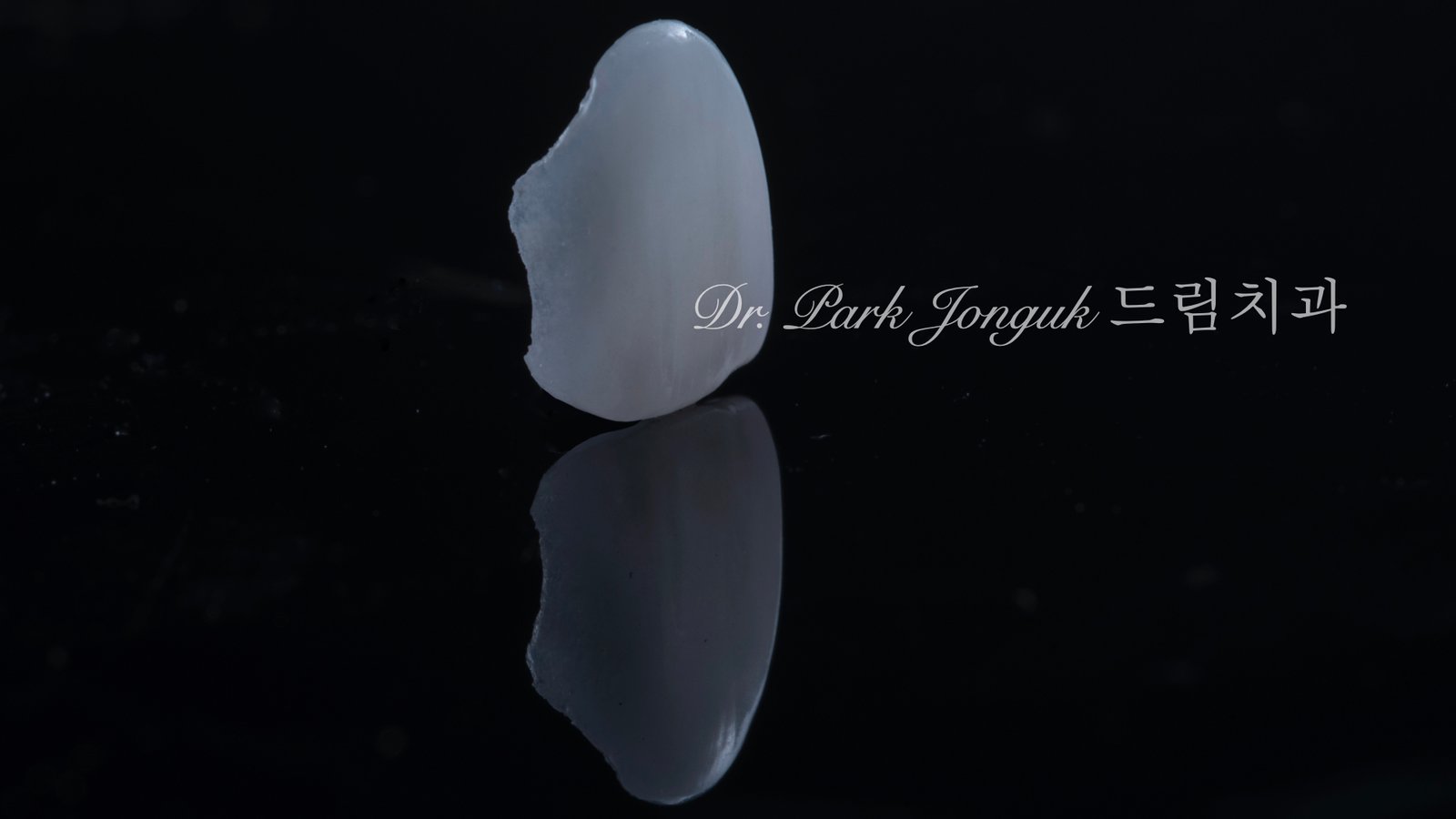 무삭제 라미네이트, No-Prep Laminate, 옥니 라미네이트, Laminate for Retroclined Teeth, 작은 치아, Small Teeth, 비교정 무삭제, Non-Orthodontic No-Prep, 수작업 빌드업, Hand-Layered Build-up, 초박형 라미네이트, Ultra-Thin Laminate