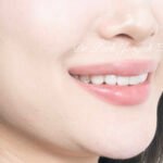 선천적 치아 변색, Congenital Tooth Discoloration, 치아 얼룩, Tooth Mottling, 내인성 변색, Intrinsic Discoloration, 미백 한계, Bleaching Limitation, 변색 차단 라미네이트, Discoloration Masking Veneer