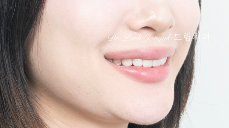 선천적 치아 변색, Congenital Tooth Discoloration, 치아 얼룩, Tooth Mottling, 내인성 변색, Intrinsic Discoloration, 미백 한계, Bleaching Limitation, 변색 차단 라미네이트, Discoloration Masking Veneer