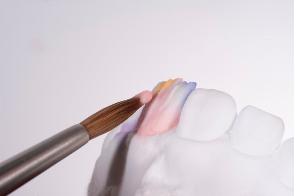 투명한 라미네이트, Translucent Laminate, 라미네이트 빌드업, Laminate Build-up, 원데이 라미네이트, One-day Laminate, 라미네이트 제작 방식, Fabrication Method, 자연스러운 라미네이트, Natural Laminate