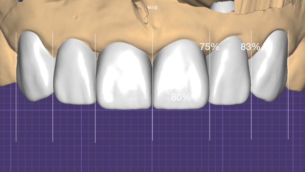 디지털 왁스업 진단