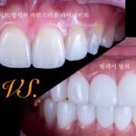 투명한 라미네이트촤 불투명하고어색한 라미네이트